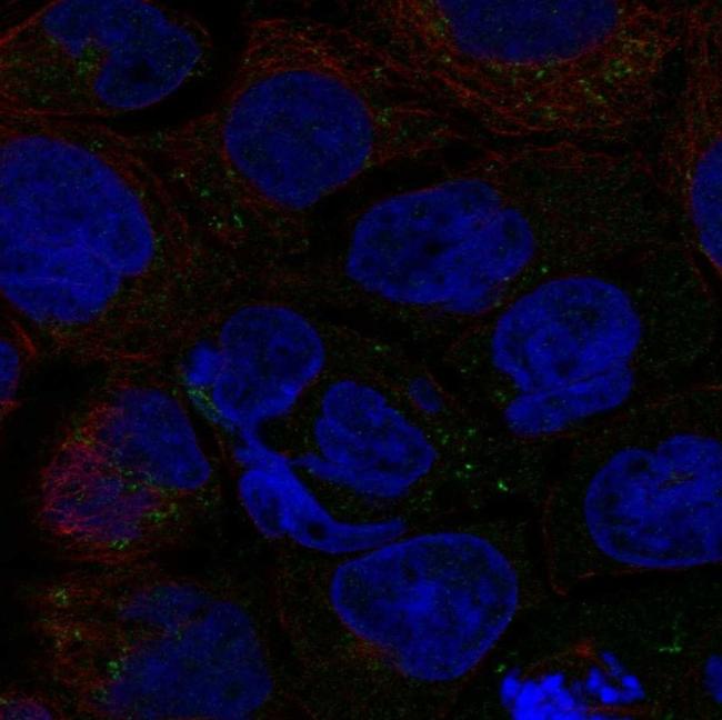 SLC6A12 Antibody in Immunocytochemistry (ICC/IF)