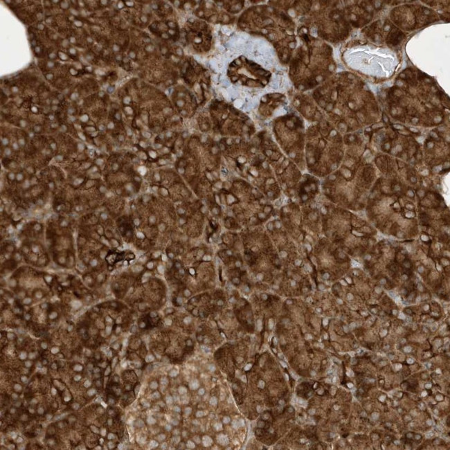 Cdc42EP3 Antibody in Immunohistochemistry (Paraffin) (IHC (P))