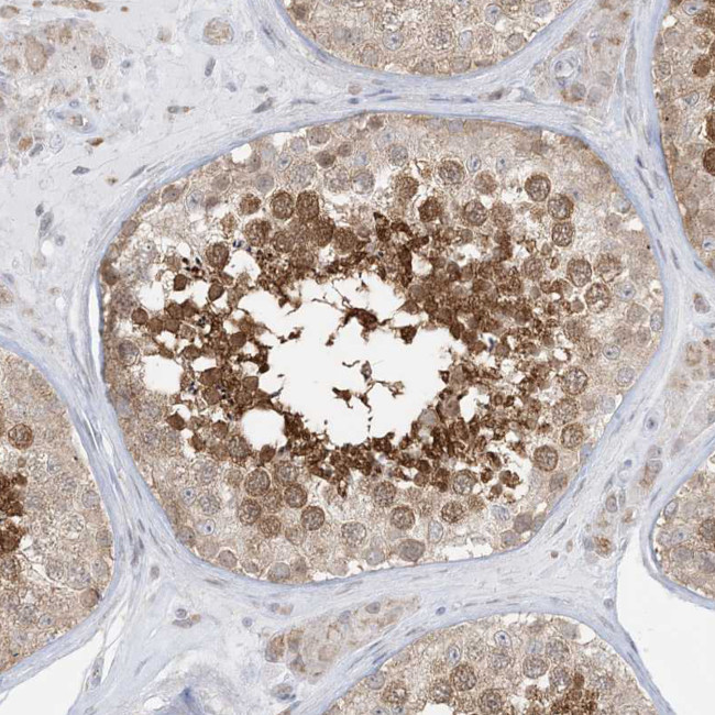 KIAA1310 Antibody in Immunohistochemistry (Paraffin) (IHC (P))