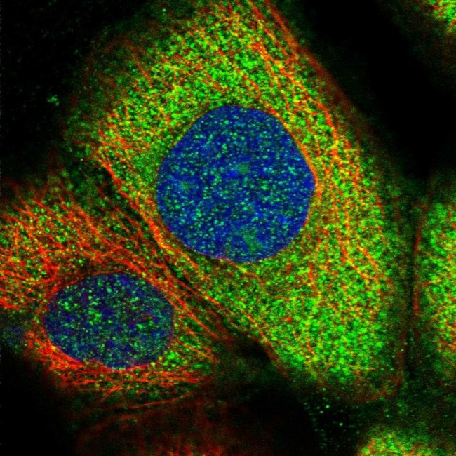 Grancalcin Antibody in Immunocytochemistry (ICC/IF)