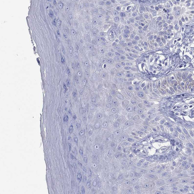 CRYGS Antibody in Immunohistochemistry (Paraffin) (IHC (P))