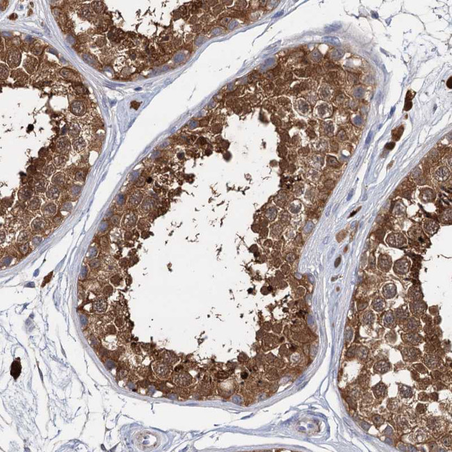 GSTM3 Antibody in Immunohistochemistry (Paraffin) (IHC (P))