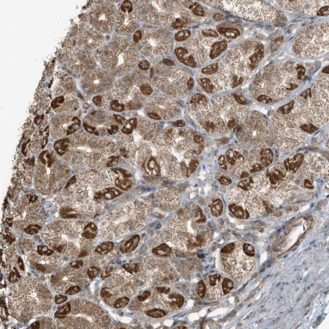 AZI2 Antibody in Immunohistochemistry (Paraffin) (IHC (P))