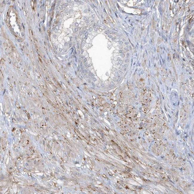 CACNB2 Antibody in Immunohistochemistry (Paraffin) (IHC (P))