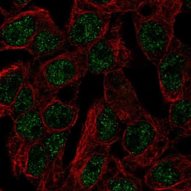 SLC5A11 Antibody in Immunocytochemistry (ICC/IF)