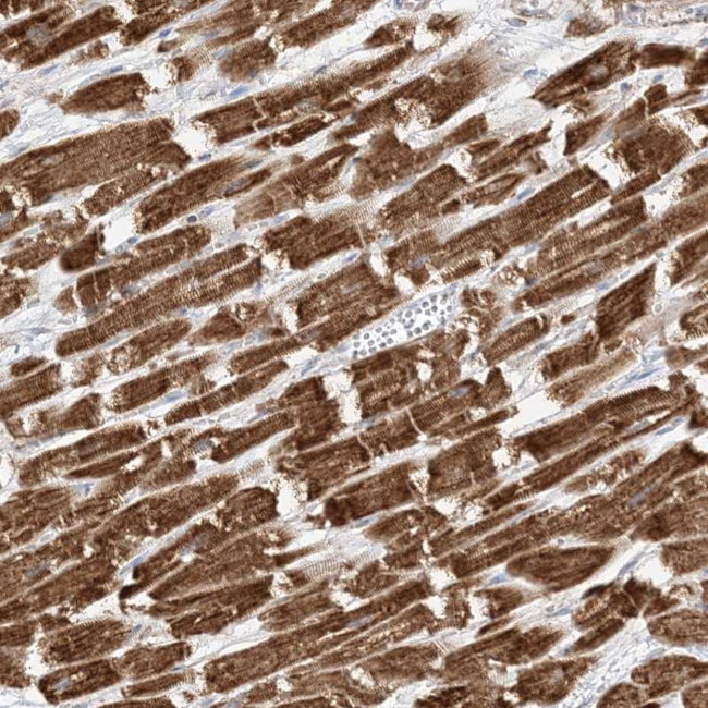 SLC25A12 Antibody in Immunohistochemistry (Paraffin) (IHC (P))