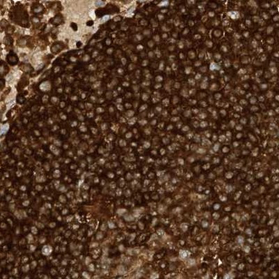 ARHGAP25 Antibody in Immunohistochemistry (Paraffin) (IHC (P))