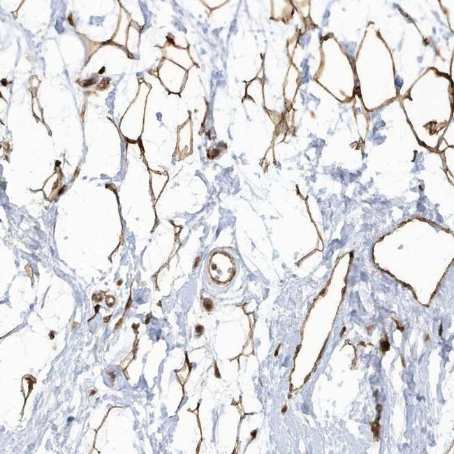 ECM2 Antibody in Immunohistochemistry (IHC)