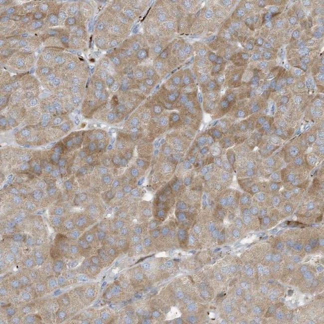 THNSL2 Antibody in Immunohistochemistry (IHC)