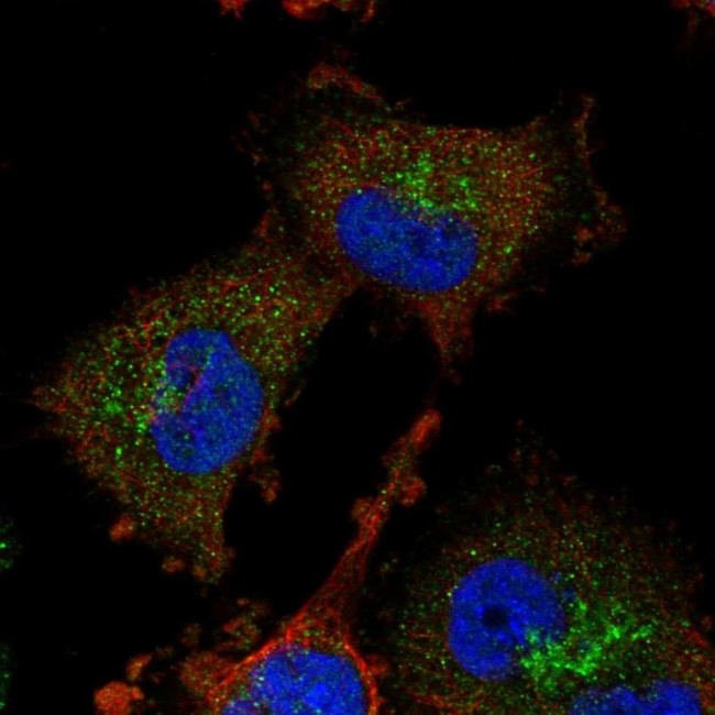 ADI1 Antibody in Immunocytochemistry (ICC/IF)