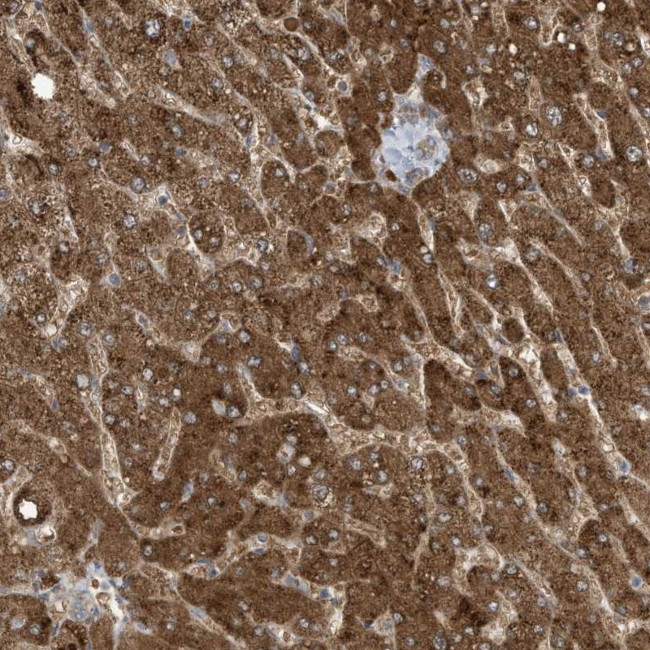 ADI1 Antibody in Immunohistochemistry (Paraffin) (IHC (P))