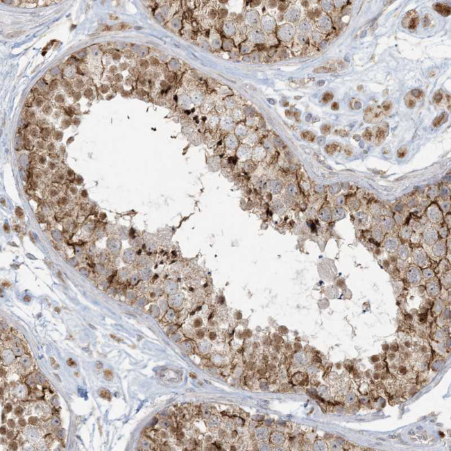 MCAT Antibody in Immunohistochemistry (Paraffin) (IHC (P))