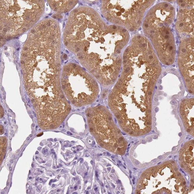 GALM Antibody in Immunohistochemistry (Paraffin) (IHC (P))