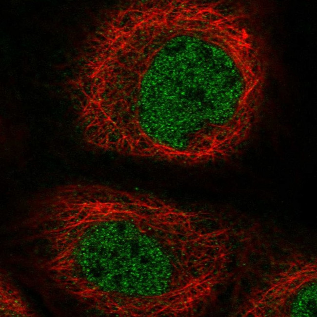 GALM Antibody in Immunocytochemistry (ICC/IF)