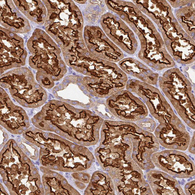 MYO6 Antibody in Immunohistochemistry (Paraffin) (IHC (P))