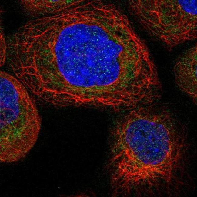 TTC21B Antibody in Immunocytochemistry (ICC/IF)