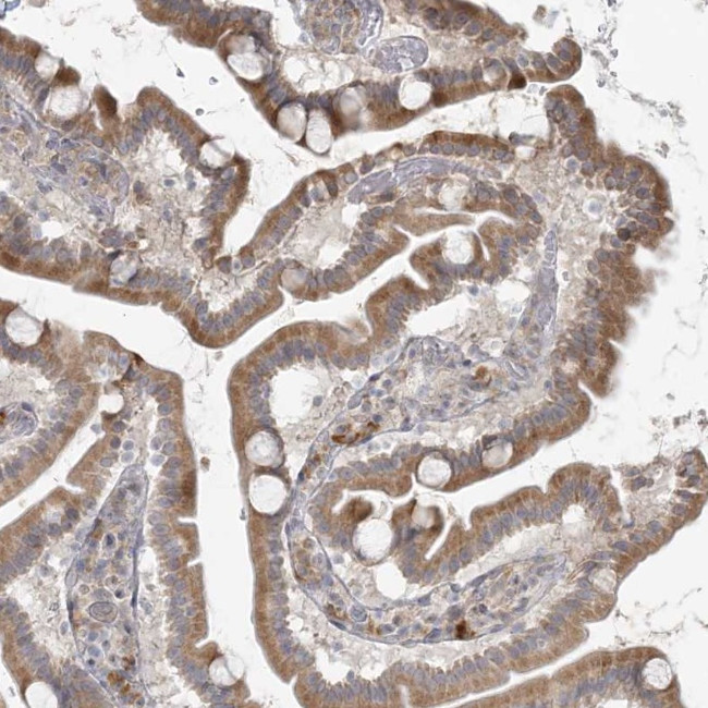 HACL1 Antibody in Immunohistochemistry (Paraffin) (IHC (P))