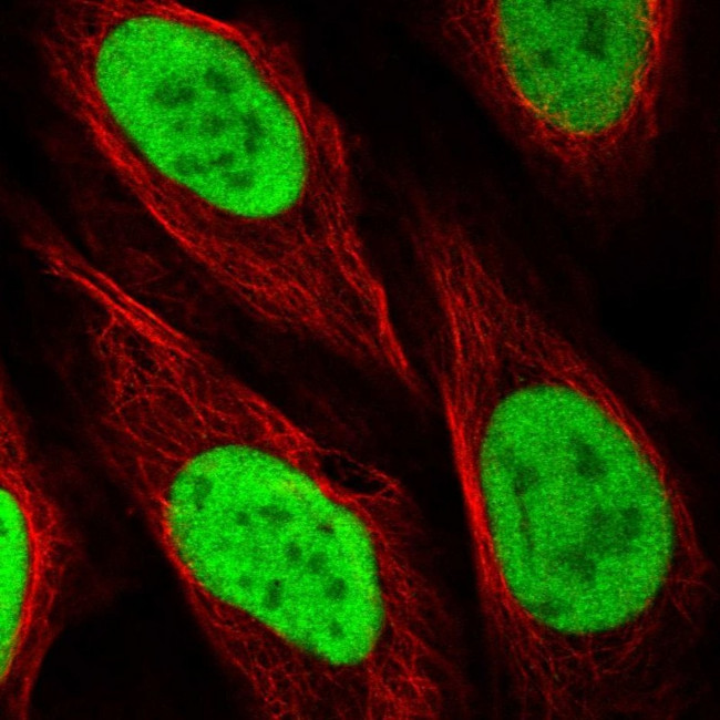 PPM1G Antibody in Immunocytochemistry (ICC/IF)