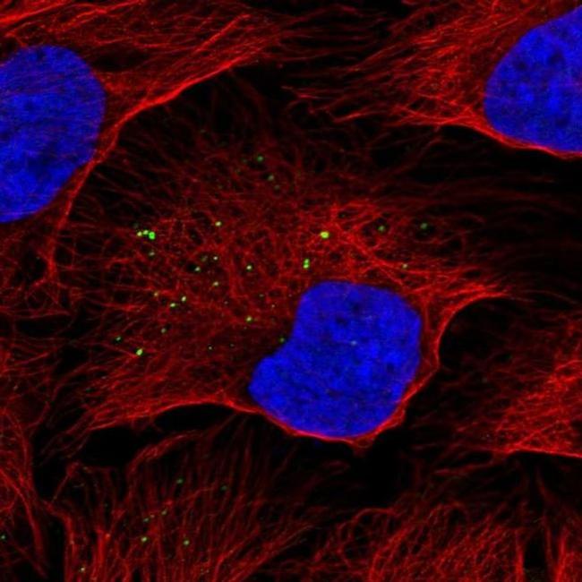 KISS1 Antibody in Immunocytochemistry (ICC/IF)