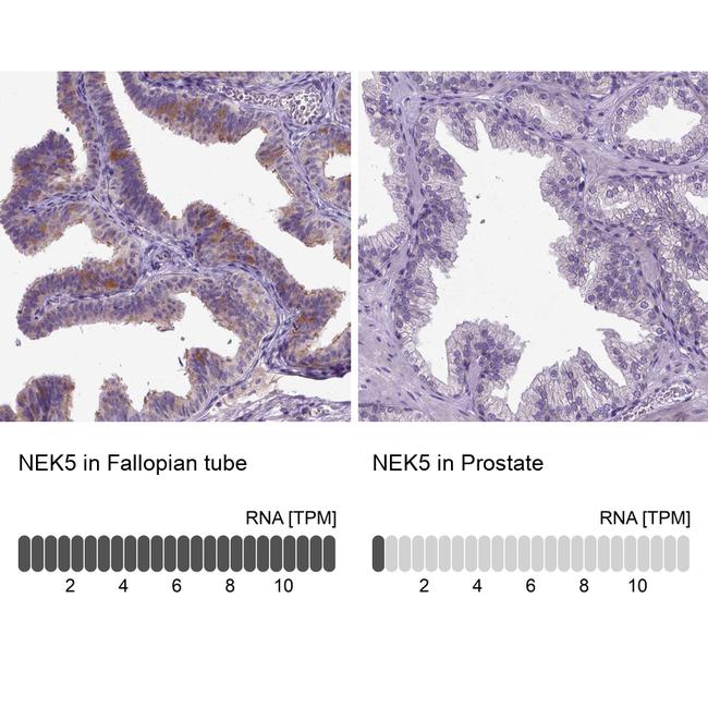 NEK5 Antibody in Immunohistochemistry (IHC)