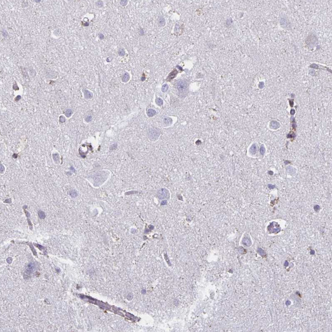 TRH Antibody in Immunohistochemistry (Paraffin) (IHC (P))