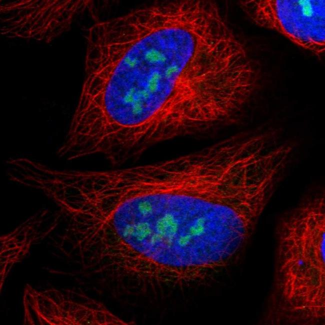 UTP3 Antibody in Immunocytochemistry (ICC/IF)