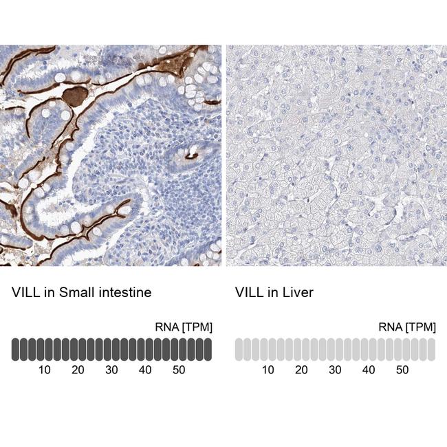 VILL Antibody in Immunohistochemistry (IHC)