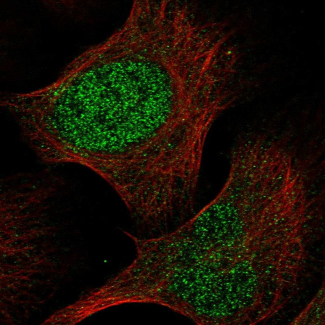 RPP40 Antibody in Immunocytochemistry (ICC/IF)