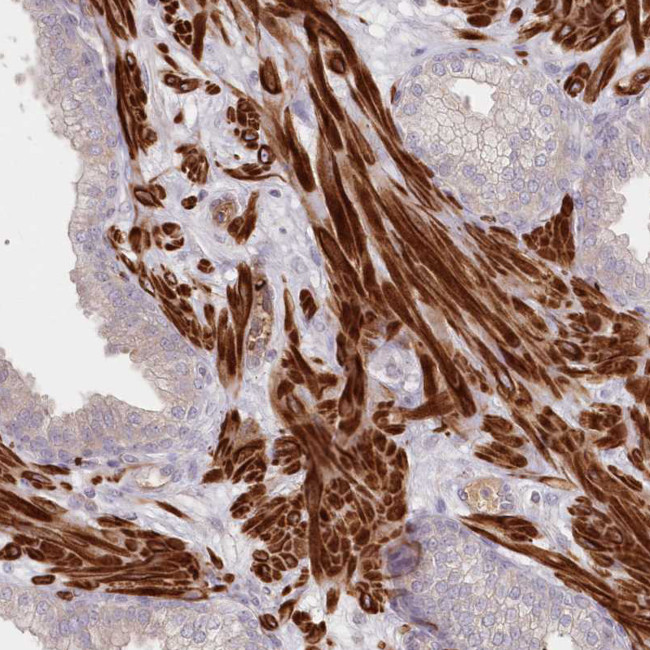 SERC1 Antibody in Immunohistochemistry (Paraffin) (IHC (P))