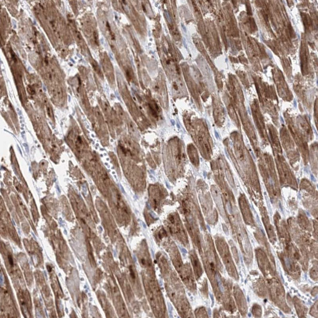 MYOZ2 Antibody in Immunohistochemistry (Paraffin) (IHC (P))