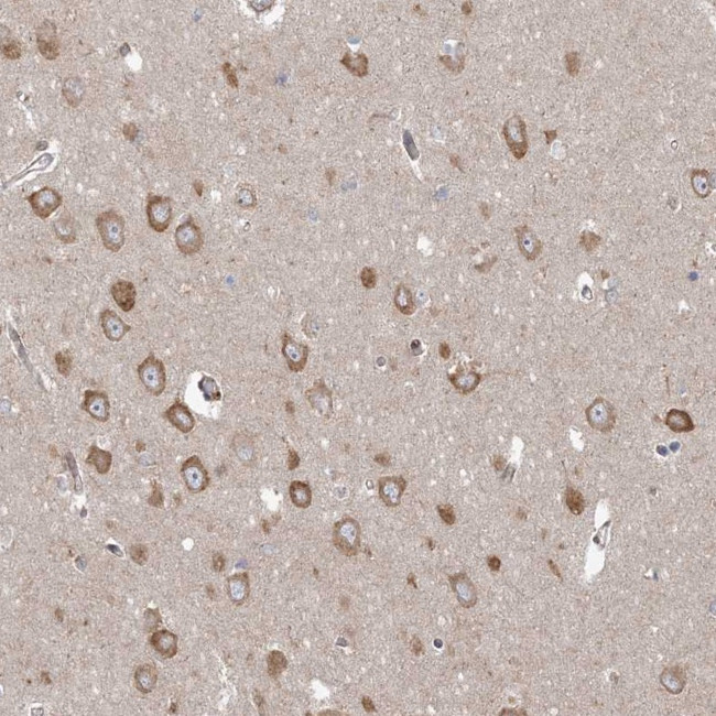 PPP2R3A Antibody in Immunohistochemistry (Paraffin) (IHC (P))