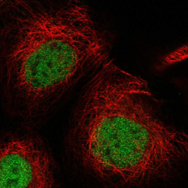 USP53 Antibody in Immunocytochemistry (ICC/IF)