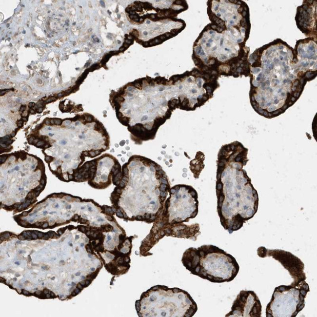 USP53 Antibody in Immunohistochemistry (Paraffin) (IHC (P))