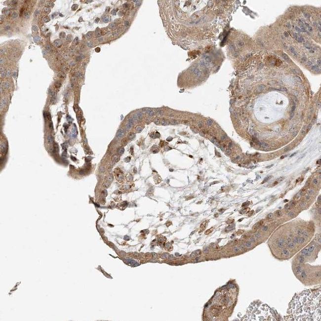 AP1AR Antibody in Immunohistochemistry (IHC)