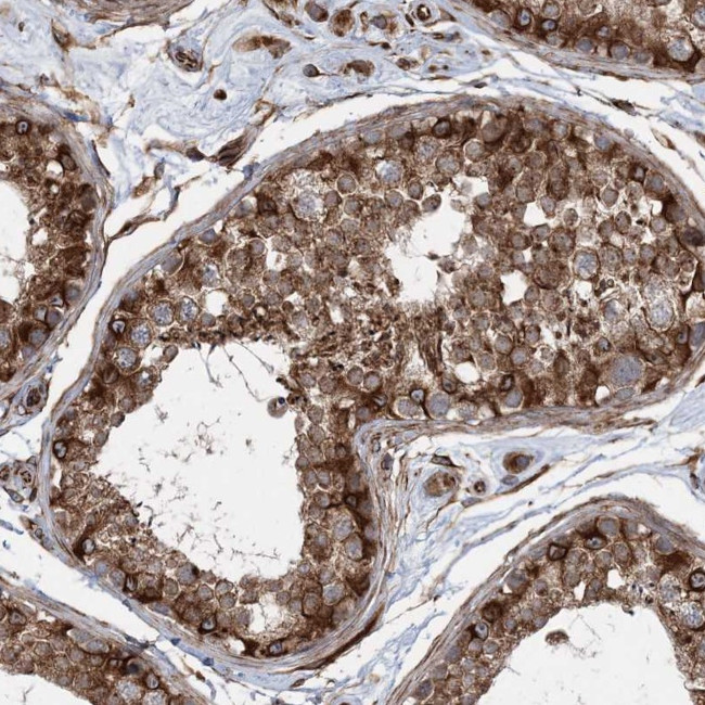 F1142 Antibody in Immunohistochemistry (Paraffin) (IHC (P))