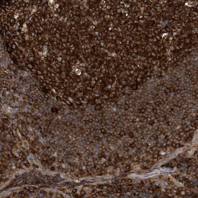 PAICS Antibody in Immunohistochemistry (Paraffin) (IHC (P))