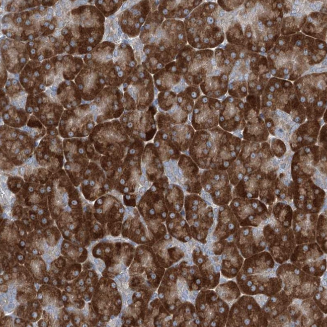 PLA2G12A Antibody in Immunohistochemistry (Paraffin) (IHC (P))