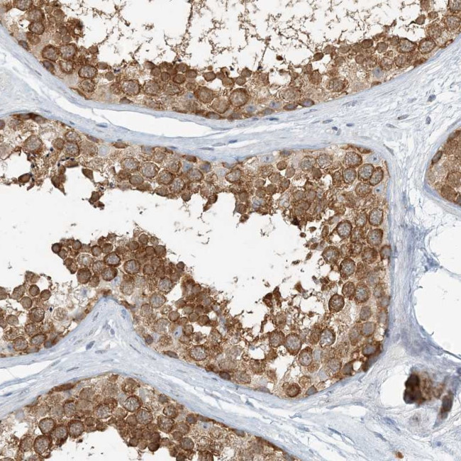 NAA11 Antibody in Immunohistochemistry (Paraffin) (IHC (P))