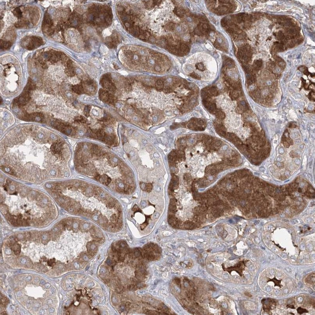 PEPP2 Antibody in Immunohistochemistry (Paraffin) (IHC (P))