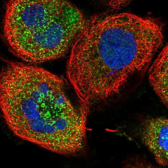 ZFYVE16 Antibody in Immunocytochemistry (ICC/IF)