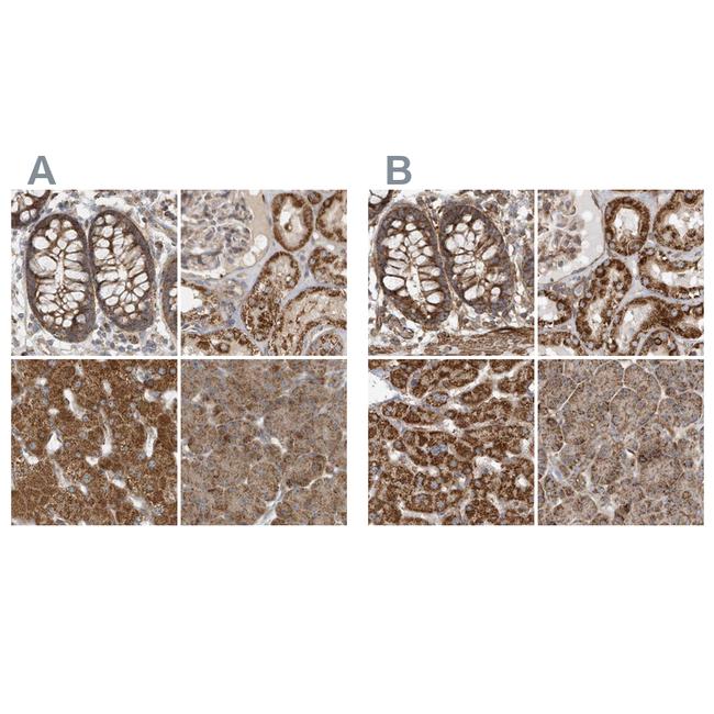 MUT Antibody in Immunohistochemistry (IHC)