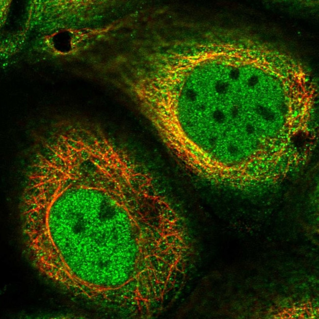 PTHLH Antibody in Immunocytochemistry (ICC/IF)