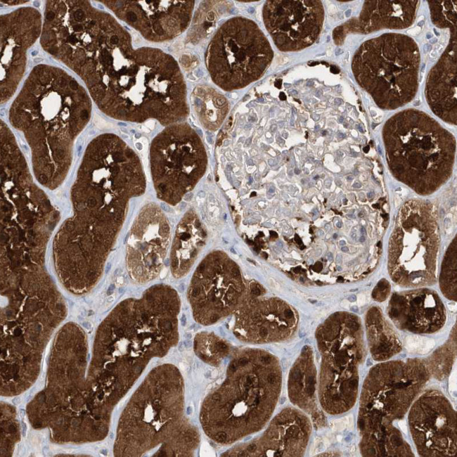 BDH2 Antibody in Immunohistochemistry (Paraffin) (IHC (P))