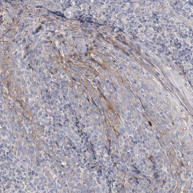 ADCK2 Antibody in Immunohistochemistry (Paraffin) (IHC (P))