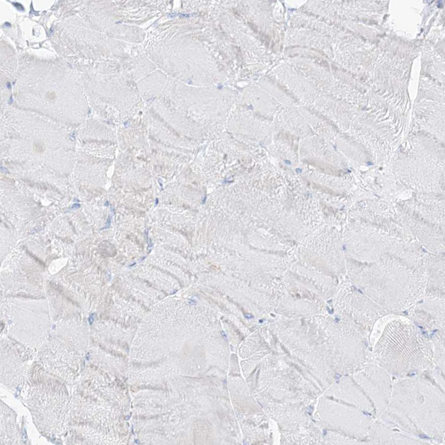 SLC26A3 Antibody in Immunohistochemistry (Paraffin) (IHC (P))