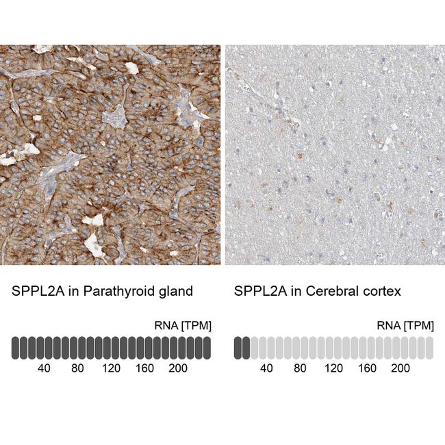 SPPL2A Antibody in Immunohistochemistry (IHC)