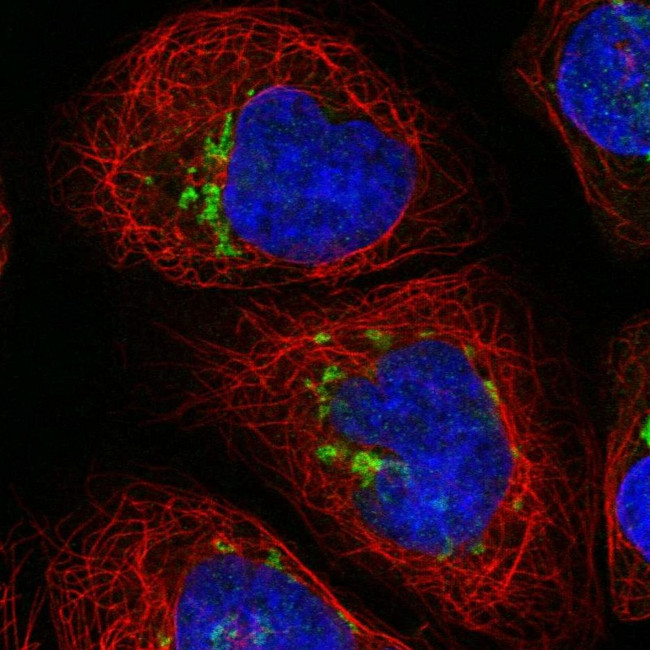 SLC35A2 Antibody in Immunocytochemistry (ICC/IF)