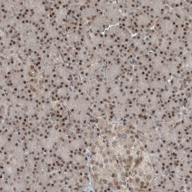 LAGE3 Antibody in Immunohistochemistry (Paraffin) (IHC (P))