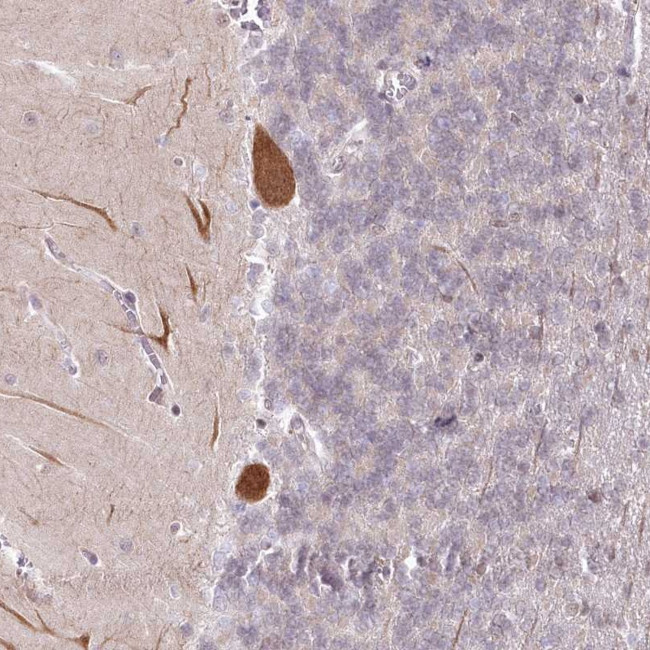 AMTN Antibody in Immunohistochemistry (Paraffin) (IHC (P))