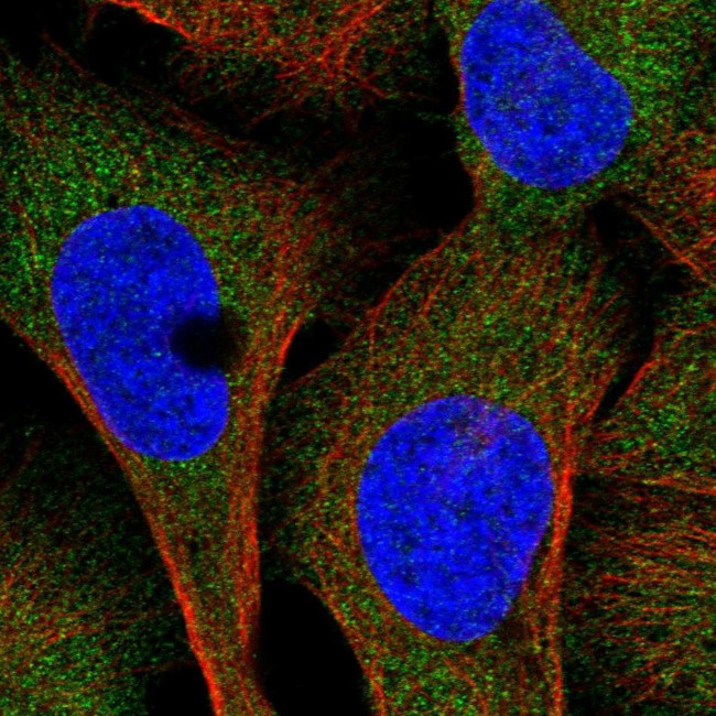 UMPS Antibody in Immunocytochemistry (ICC/IF)